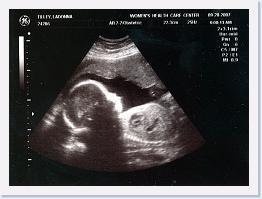 September - Sara Ultrasound - (2) * 1067 x 790 * (1.05MB)